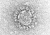 Electron microscope image of coronavirus particle